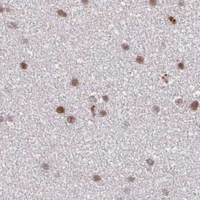 Immunohistochemistry-Paraffin: PSMD7 Antibody [NBP2-38780]