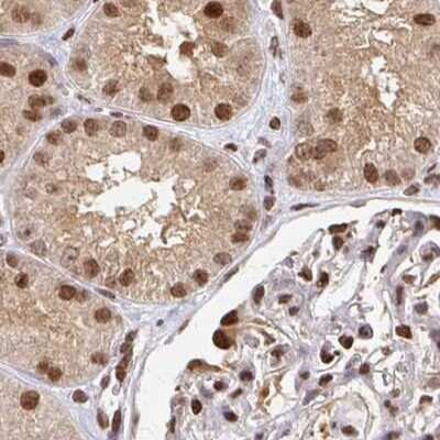 Immunohistochemistry-Paraffin: PSMD7 Antibody [NBP2-38780]