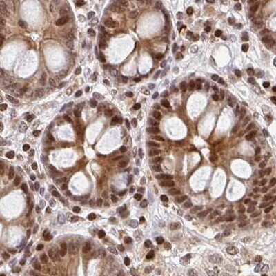 Immunohistochemistry-Paraffin: PSMD7 Antibody [NBP2-38780]