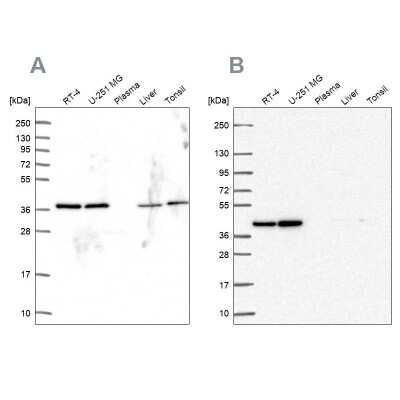 Western Blot: PSMD7 Antibody [NBP2-38612]