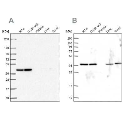 Western Blot: PSMD7 Antibody [NBP2-38780]