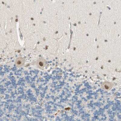 Immunohistochemistry-Paraffin: PSMD8 Antibody [NBP1-83254]
