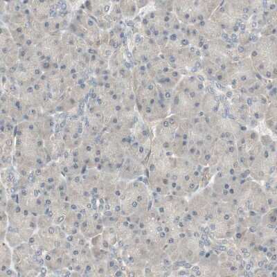 Immunohistochemistry-Paraffin: PSMD8 Antibody [NBP1-83254]