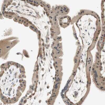 Immunohistochemistry-Paraffin: PSMD8 Antibody [NBP1-83254]