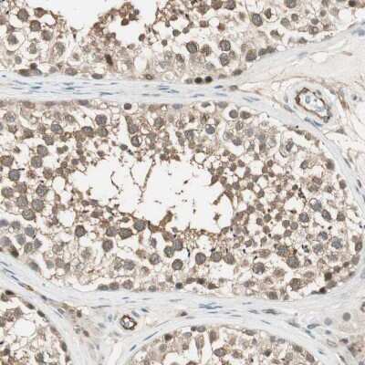 Immunohistochemistry-Paraffin: PSMD8 Antibody [NBP1-83254]