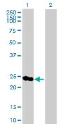 Western Blot: PSMD8 Antibody [H00005714-B02P]