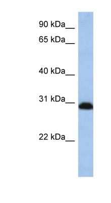 Western Blot: PSMD8 Antibody [NBP1-54588]