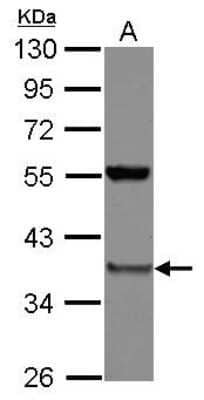 Western Blot: PSMD8 Antibody [NBP2-19989]