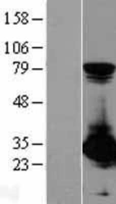 Western Blot: PA28 Activator alpha Subunit/PSME1 Overexpression Lysate [NBL1-14907]