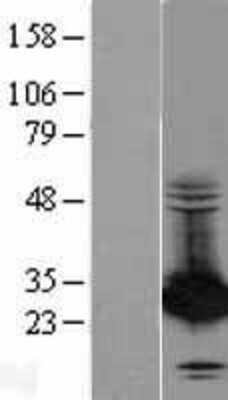 Western Blot: PA28 Activator beta Subunit/PSME2 Overexpression Lysate [NBL1-14908]