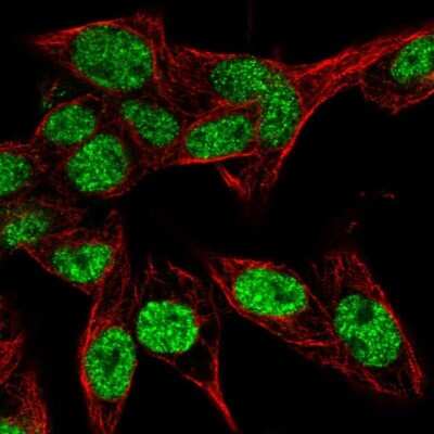 Immunocytochemistry/ Immunofluorescence: PSME4 Antibody [NBP2-32575]