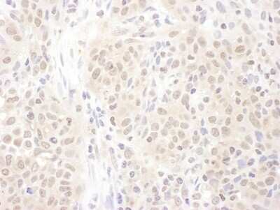 Immunohistochemistry-Paraffin: PSME4 Antibody [NBP2-22236]