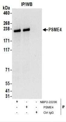 Immunoprecipitation: PSME4 Antibody [NBP2-22236]