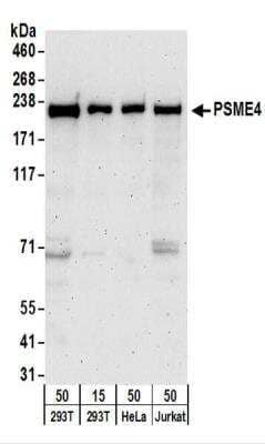 Western Blot: PSME4 Antibody [NBP2-22236]