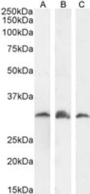 Western Blot: PSMF1 AntibodyIsoform 1 [NB100-1178]