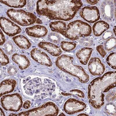 Immunohistochemistry-Paraffin: PSMF1 Antibody [NBP1-80910]