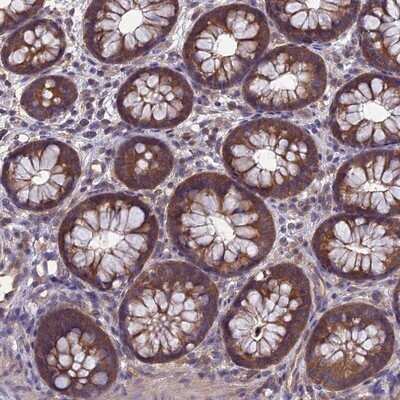 Immunohistochemistry-Paraffin: PSMF1 Antibody [NBP1-80911]