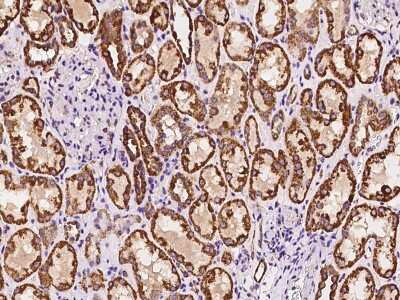 Immunohistochemistry-Paraffin: PSMF1 Antibody [NBP2-98614]