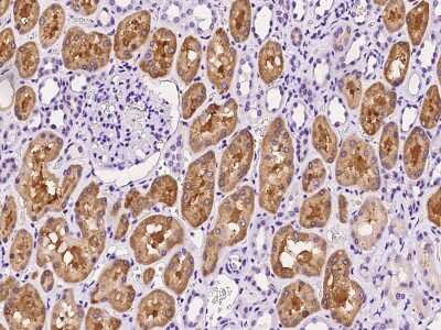 Immunohistochemistry-Paraffin: PSMF1 Antibody [NBP2-99618]