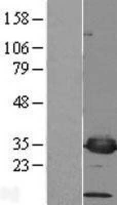 Western Blot: PSMF1 Overexpression Lysate [NBL1-14910]