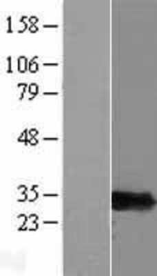 Western Blot: PSMF1 Overexpression Lysate [NBP2-04951]