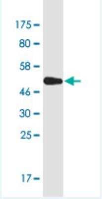 Western Blot: PSMG1 Antibody (4B9) [H00008624-M03-100ug]