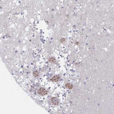 Immunohistochemistry: PSMG1 Antibody [NBP2-33820]