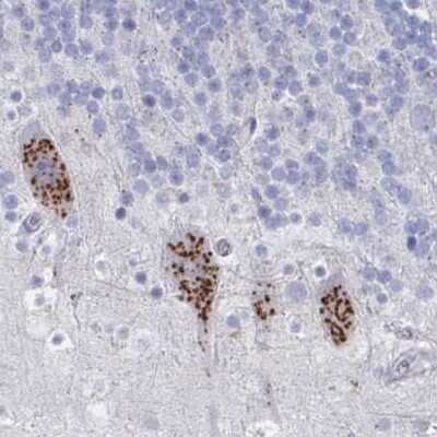 Immunohistochemistry: PSMG1 Antibody [NBP2-33820]
