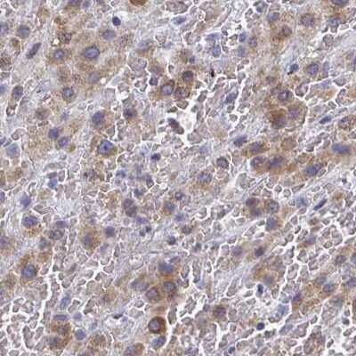 Immunohistochemistry: PSMG1 Antibody [NBP2-33820]