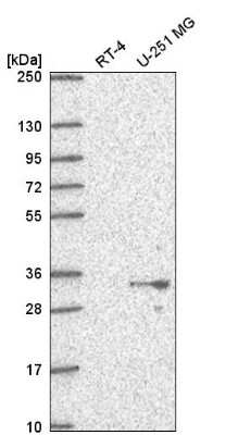 Western Blot: PSMG1 Antibody [NBP2-55971]