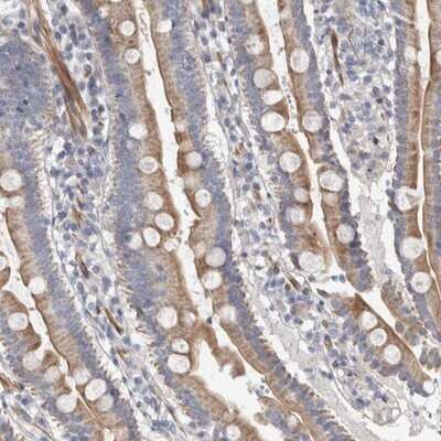 Immunohistochemistry-Paraffin: PSMG3 Antibody [NBP1-86725]