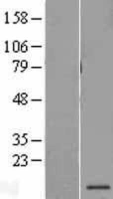 Western Blot: PSMG3 Overexpression Lysate [NBL1-14913]