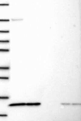 Western Blot: PSMG4 Antibody [NBP3-17615]