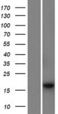 Western Blot: PSMG4 Overexpression Lysate [NBP2-09480]