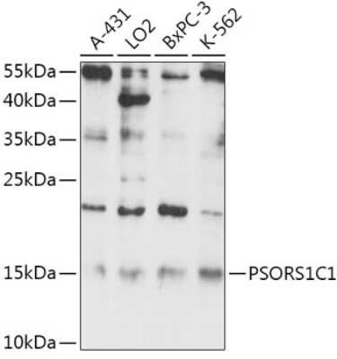 Western Blot: PSORS1C1 AntibodyAzide and BSA Free [NBP3-05672]