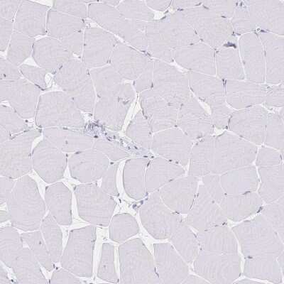 Immunohistochemistry-Paraffin: PSORS1C2 Antibody [NBP2-32589]