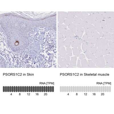 Immunohistochemistry-Paraffin: PSORS1C2 Antibody [NBP2-32589]