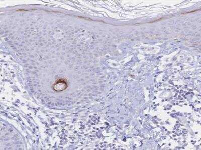 Immunohistochemistry-Paraffin: PSORS1C2 Antibody [NBP2-32589]