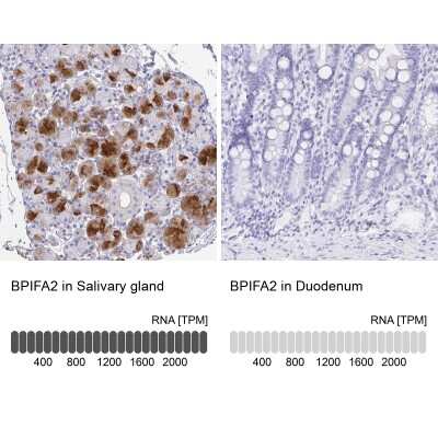 Immunohistochemistry-Paraffin: PSP/BPIFA2 Antibody [NBP1-91704]