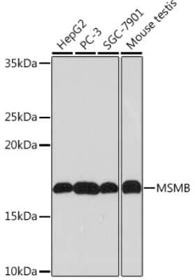 Western Blot: PSP94/MSMB Antibody (4L8B5) [NBP3-16346]