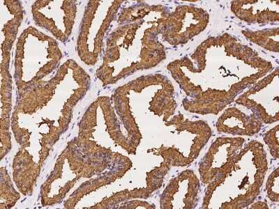 Immunohistochemistry-Paraffin: PSP94/MSMB Antibody [NBP2-97147]