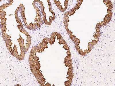Immunohistochemistry-Paraffin: PSP94/MSMB Antibody [NBP2-99444]
