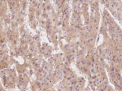 Immunohistochemistry-Paraffin: PSP94/MSMB Antibody [NBP2-99444]