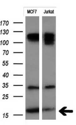 Western Blot: PSP94/MSMB Antibody (OTI3D5)Azide and BSA Free [NBP2-73625]