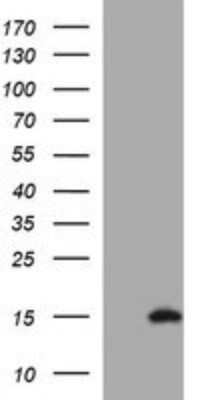 Western Blot: PSP94/MSMB Antibody (OTI3D5)Azide and BSA Free [NBP2-73625]