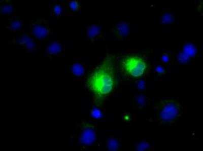 Immunocytochemistry/ Immunofluorescence: PSP94/MSMB Antibody (OTI6C7) - Azide and BSA Free [NBP2-73624]