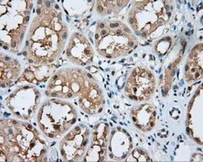 Immunohistochemistry: PSP94/MSMB Antibody (OTI6C7) - Azide and BSA Free [NBP2-73624]