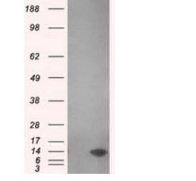 Western Blot: PSP94/MSMB Antibody (OTI6C7)Azide and BSA Free [NBP2-73624]