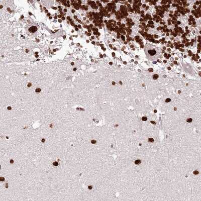 Immunohistochemistry-Paraffin: PSPC1 Antibody [NBP1-83801]