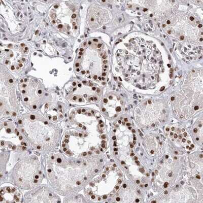 Immunohistochemistry-Paraffin: PSPC1 Antibody [NBP1-83801]